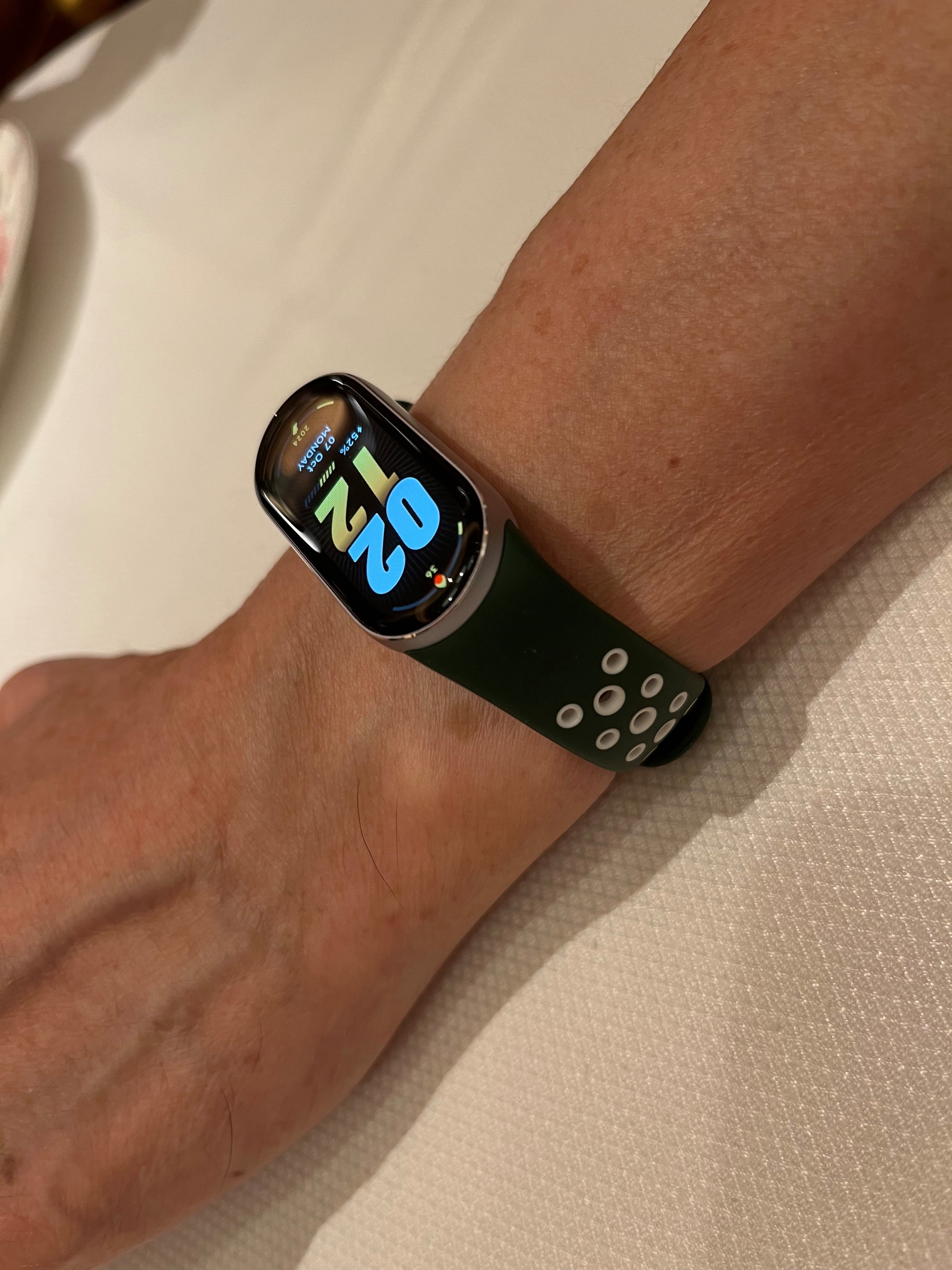 小米手环腕带替换(小米手环腕带断了怎么修复)