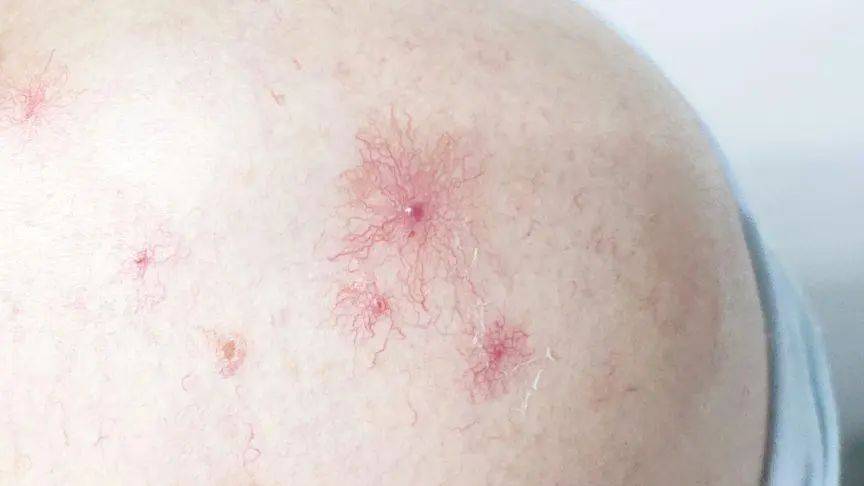 小红点破解版(红点杀手破解版下载)